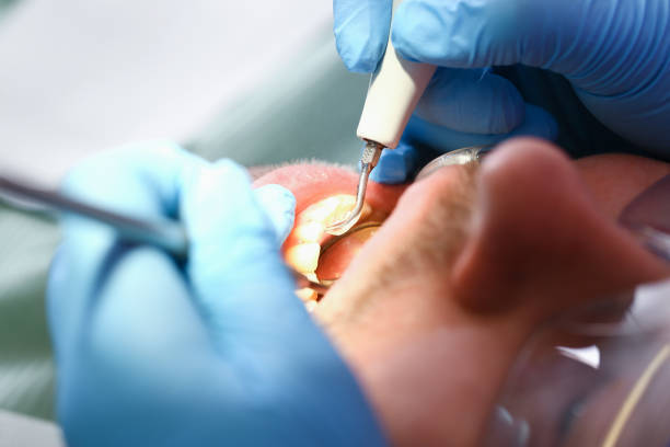 Best Emergency Dental Surgery in Batavia, IL