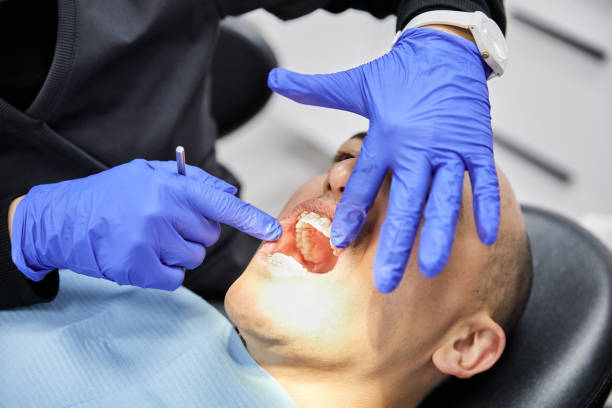 Best Emergency Tooth Extraction in Batavia, IL