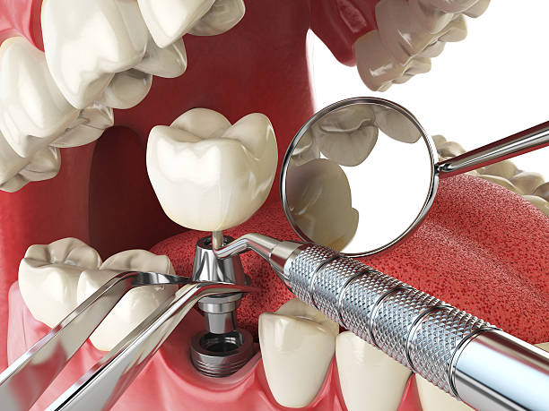 Best Emergency Treatment for Toothache in Batavia, IL